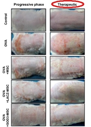 아토피피부염이 유발된 동물(쥐)에 항산화효소 SOD3를 도입한 중간엽 줄기세포를 투여한 결과, 피부 두께 및 염증반응이 효과적으로 감소된 것을 확인했다[사진=서울성모병원]