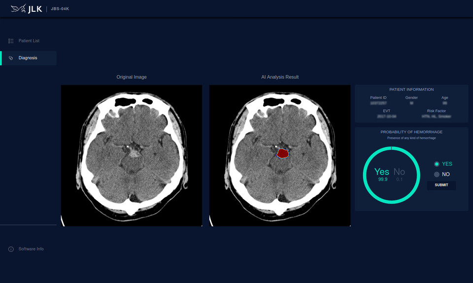제이엘케이의 인공지능 뇌출혈 분석 솔루션 ‘JBS-04K’/출처=제이엘케이