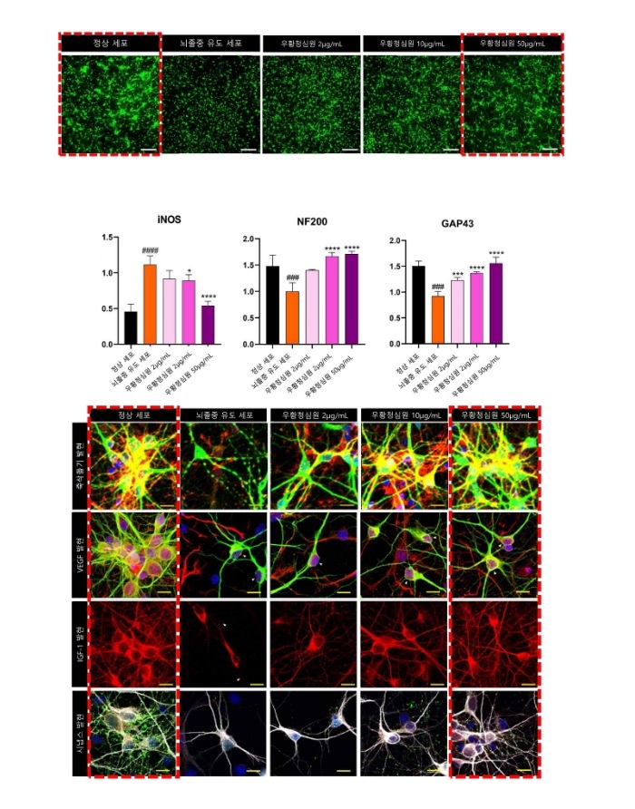 (상) 우황청심원은 농도에 비례해 뇌졸중 상태를 유도한 대뇌피질 신경세포 사멸을 억제했다. (중) 우황청심원은 iNOS의 발현량을 낮춰 신경세포의 산화스트레스를 억제하고 NF200, GAP-43 등 신경재생인자의 활성을 촉진해 뇌졸중 예방에 기여하는 것으로 분석됐다. (하) 우황청심원 농도별 축삭돌기와 VEGF, IGF-1, 시냅스 발현량 비교. 농도가 높을수록 모든 지표에서 발현이 증가했다./출처=자생한방병원
