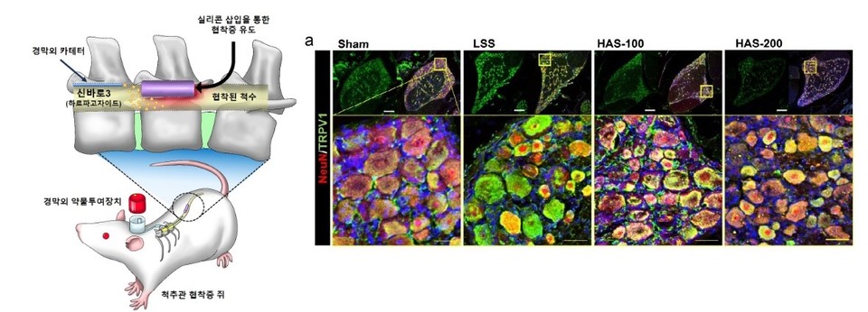 (왼쪽)실험에 활용된 동물실험 모델 및 (오른쪽)신경세포의 실험군별 통증 수용체(TRPV1) 발현 모습. 하르파고사이드 투여군에서 초록색으로 염색된 TRPV1이 감소한 것을 확인할 수 있다/사진=자생한방병원