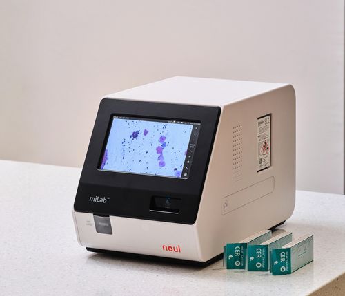 [AI의료]노을, 멕시코 진출로 중남미 자궁경부암 진단 시장 확대 外 제이... - 뉴스 썸네일 이미지