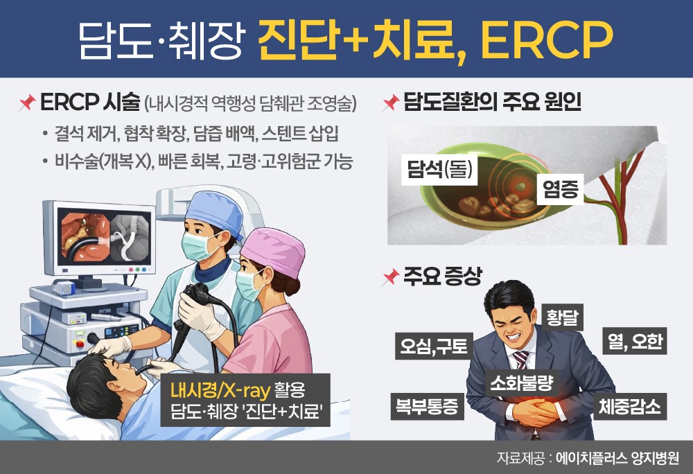 담도·췌장 질환, ERCP로 진단과 치료 동시 시술에 주목