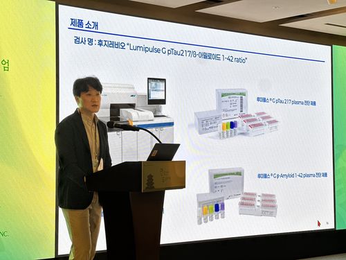 [BIO톡]대웅바이오, 혈액으로 알츠하이머 진단 기술 도입 外 바이젠셀·... - 뉴스 썸네일 이미지